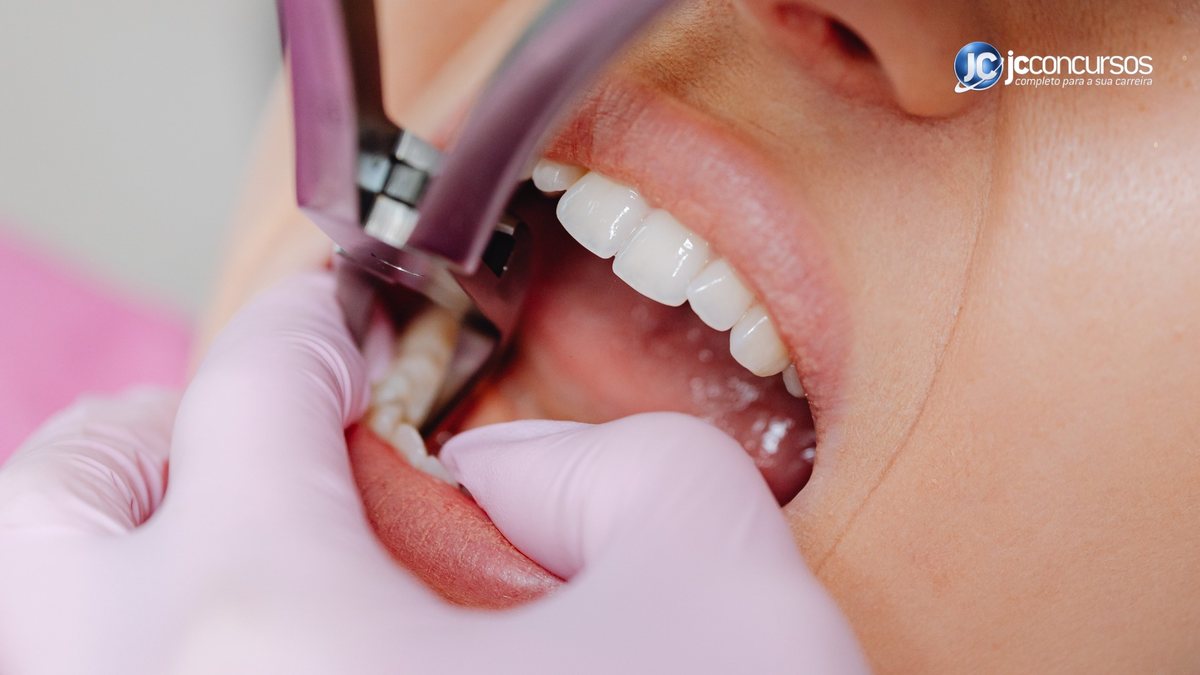 Pessoa na cadeira do dentista com boca aberta