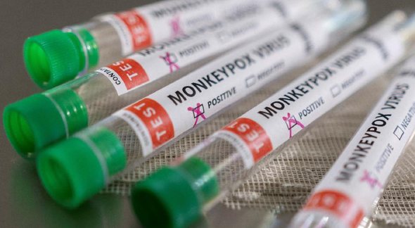 Vacina da varíola dos macacos: tubos para teste de detecção da doença - Divulgação/Agência Brasil