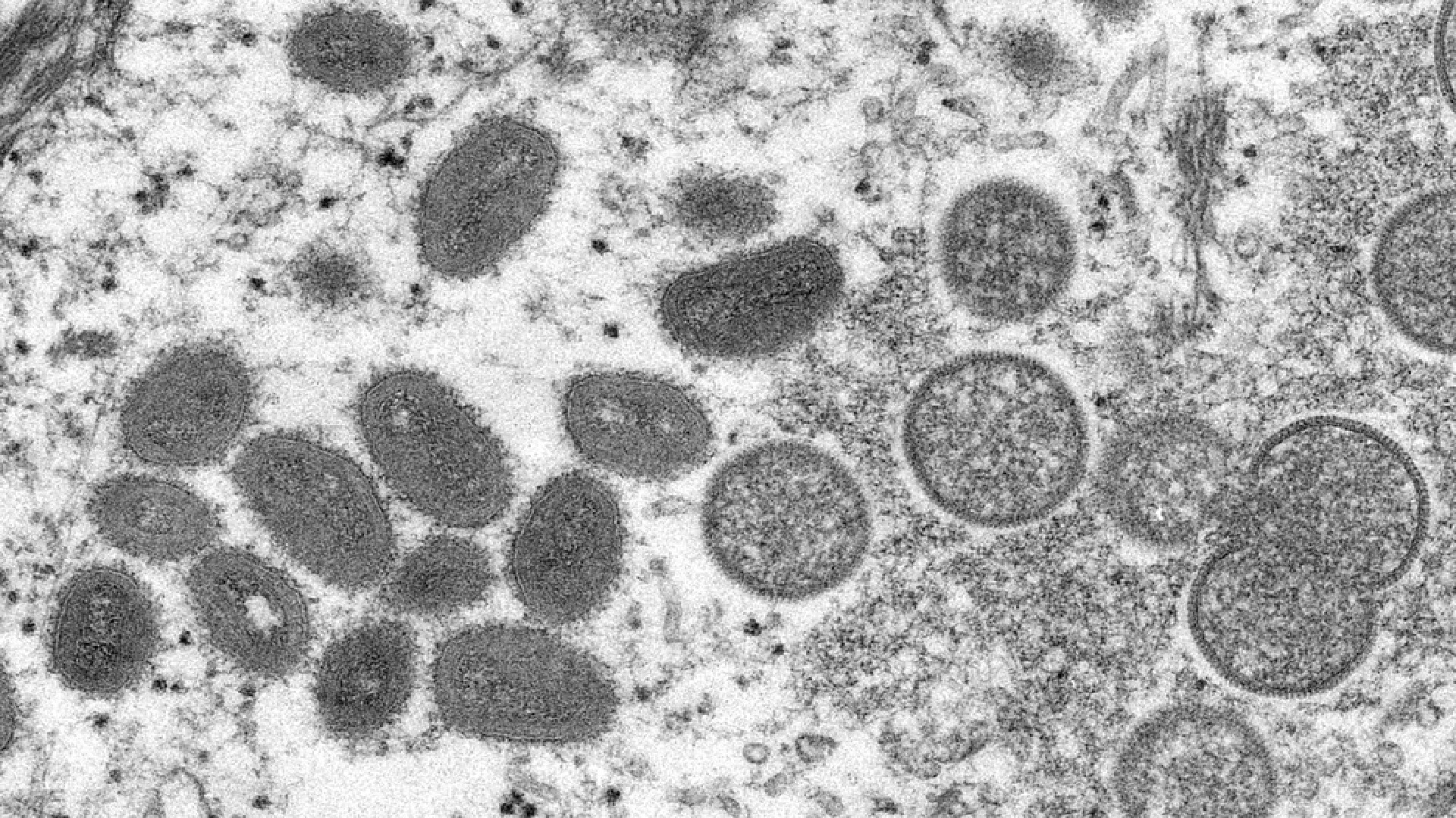 variola do macaco centro de controle de doencas divulgacao